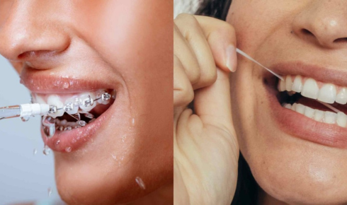 Water flosser