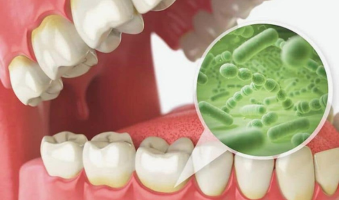 oral probiotics