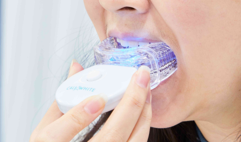whitening strips